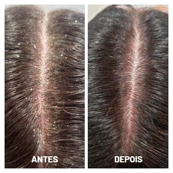 antes e depois (1)