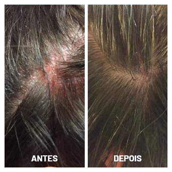 antes e depois (2)