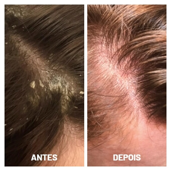 antes e depois (3)