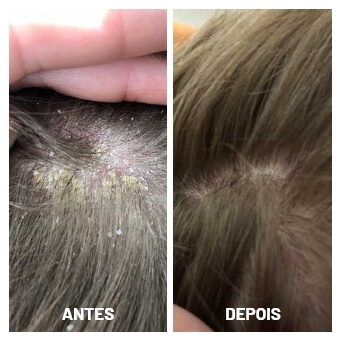 antes e depois (4)